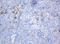 SRP Receptor Subunit Beta antibody, LS-C787133, Lifespan Biosciences, Immunohistochemistry paraffin image 