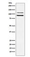 Interleukin Enhancer Binding Factor 3 antibody, M02313-1, Boster Biological Technology, Western Blot image 