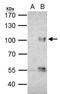 Forkhead Box O3 antibody, GTX100277, GeneTex, Immunoprecipitation image 