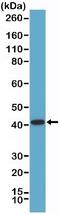 Alpha-Methylacyl-CoA Racemase antibody, NBP2-77417, Novus Biologicals, Western Blot image 