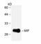 Macrophage Migration Inhibitory Factor antibody, abx018079, Abbexa, Enzyme Linked Immunosorbent Assay image 