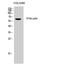 General Transcription Factor IIH Subunit 2 antibody, A08466, Boster Biological Technology, Western Blot image 
