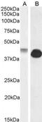 Gap Junction Protein Alpha 1 antibody, GTX88424, GeneTex, Western Blot image 