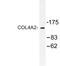 Collagen Type IV Alpha 2 Chain antibody, LS-C176967, Lifespan Biosciences, Western Blot image 