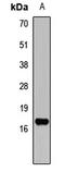 Natriuretic Peptide A antibody, LS-C667710, Lifespan Biosciences, Western Blot image 