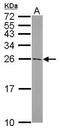 Autophagy Related 5 antibody, PA5-27684, Invitrogen Antibodies, Western Blot image 