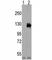 Transient Receptor Potential Cation Channel Subfamily M Member 8 antibody, F51111-0.4ML, NSJ Bioreagents, Western Blot image 