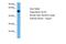 LXR beta antibody, PA5-69243, Invitrogen Antibodies, Western Blot image 