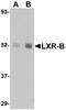 Nuclear Receptor Subfamily 1 Group H Member 2 antibody, NBP1-76256, Novus Biologicals, Western Blot image 