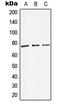Dopamine Beta-Hydroxylase antibody, LS-C352106, Lifespan Biosciences, Western Blot image 
