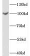 SPOC Domain Containing 1 antibody, FNab08185, FineTest, Western Blot image 