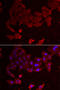 Folliculin antibody, STJ28576, St John