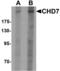 Chromodomain Helicase DNA Binding Protein 7 antibody, A01533, Boster Biological Technology, Western Blot image 