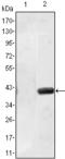 Matrilin 1 antibody, M07385, Boster Biological Technology, Western Blot image 