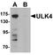 Unc-51 Like Kinase 4 antibody, TA326686, Origene, Western Blot image 