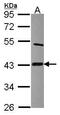 LAS antibody, GTX115528, GeneTex, Western Blot image 