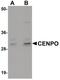 Centromere Protein O antibody, PA5-20826, Invitrogen Antibodies, Western Blot image 