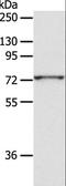 ADAM Metallopeptidase Domain 10 antibody, LS-C404444, Lifespan Biosciences, Western Blot image 