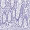 Cystatin D antibody, HPA061449, Atlas Antibodies, Immunohistochemistry paraffin image 