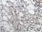 Kinase Insert Domain Receptor antibody, ab2349, Abcam, Immunohistochemistry paraffin image 