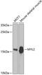 Myosin Light Chain 2 antibody, GTX33339, GeneTex, Western Blot image 