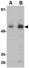 Presenilin Associated Rhomboid Like antibody, GTX85382, GeneTex, Western Blot image 