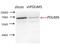 PDZ And LIM Domain 5 antibody, 10530-1-AP, Proteintech Group, Western Blot image 