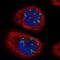 Treacher Collins syndrome protein antibody, NBP1-86909, Novus Biologicals, Immunofluorescence image 