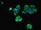 Glutamate Ionotropic Receptor AMPA Type Subunit 3 antibody, LS-C369717, Lifespan Biosciences, Immunofluorescence image 