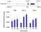 Histone Deacetylase 11 antibody, PA5-11249, Invitrogen Antibodies, Chromatin Immunoprecipitation image 