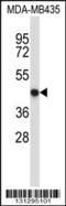 Nuclear Factor, Erythroid 2 antibody, 57-123, ProSci, Western Blot image 