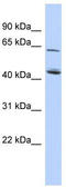 NAD Kinase 2, Mitochondrial antibody, TA338318, Origene, Western Blot image 