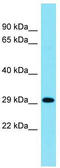 Inhibitory Synaptic Factor 1 antibody, TA334887, Origene, Western Blot image 