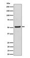 Nucleoporin 50 antibody, M06152-1, Boster Biological Technology, Western Blot image 