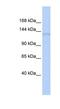 ERCC Excision Repair 5, Endonuclease antibody, NBP1-56397, Novus Biologicals, Western Blot image 