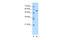 Carboxylesterase 1 antibody, 29-659, ProSci, Western Blot image 