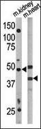 Autophagy Related 4A Cysteine Peptidase antibody, LS-C156583, Lifespan Biosciences, Western Blot image 