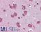 Period Circadian Regulator 2 antibody, LS-B4477, Lifespan Biosciences, Immunohistochemistry paraffin image 