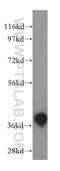 Guided Entry Of Tail-Anchored Proteins Factor 3, ATPase antibody, 15450-1-AP, Proteintech Group, Western Blot image 