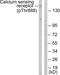 Calcium Sensing Receptor antibody, PA5-38432, Invitrogen Antibodies, Western Blot image 