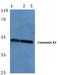 Gap Junction Protein Alpha 1 antibody, A00599S369, Boster Biological Technology, Western Blot image 