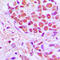 Serine And Arginine Rich Splicing Factor 4 antibody, LS-C352834, Lifespan Biosciences, Immunohistochemistry paraffin image 