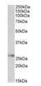 Major Histocompatibility Complex, Class II, DQ Alpha 2 antibody, orb125059, Biorbyt, Western Blot image 