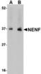 Neudesin Neurotrophic Factor antibody, TA306626, Origene, Western Blot image 