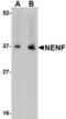 Neudesin Neurotrophic Factor antibody, TA306626, Origene, Western Blot image 