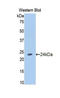 Nitric Oxide Synthase 1 antibody, LS-C299796, Lifespan Biosciences, Western Blot image 