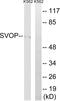 SV2 Related Protein antibody, A15475-1, Boster Biological Technology, Western Blot image 
