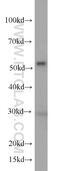 Peptidyl-prolyl cis-trans isomerase FKBP4 antibody, 66040-1-Ig, Proteintech Group, Western Blot image 