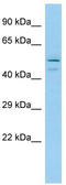 Tubulointerstitial Nephritis Antigen antibody, TA334541, Origene, Western Blot image 