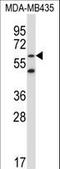 Zinc Finger Protein 479 antibody, LS-C160883, Lifespan Biosciences, Western Blot image 